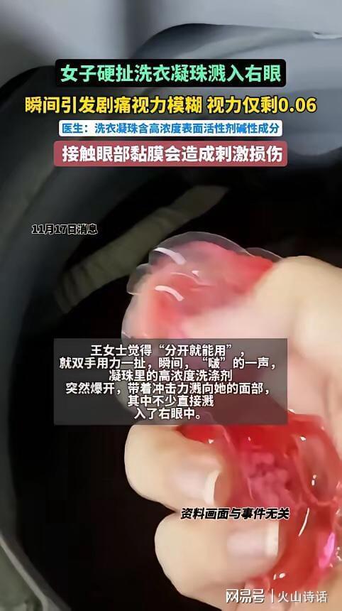 州一女子撕扯凝珠发生意外致眼睛失明麻将胡了恐怖！洗衣引发“爆炸”杭(图1)